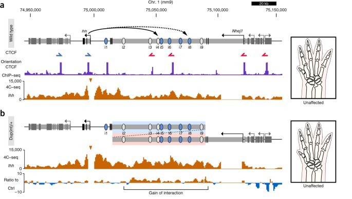 Composition and dosage of a multipartite enhancer cluster control developmental expression of Ihh Indian hedgehog